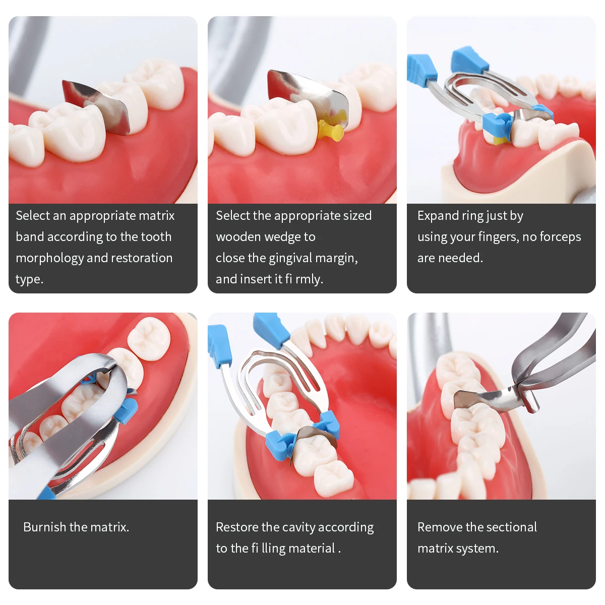 Dental Matrix Sectional Contoured Clamps Wedges Metal Spring Clip Rings Plier Set with Replacement Parts Dentistry Tools