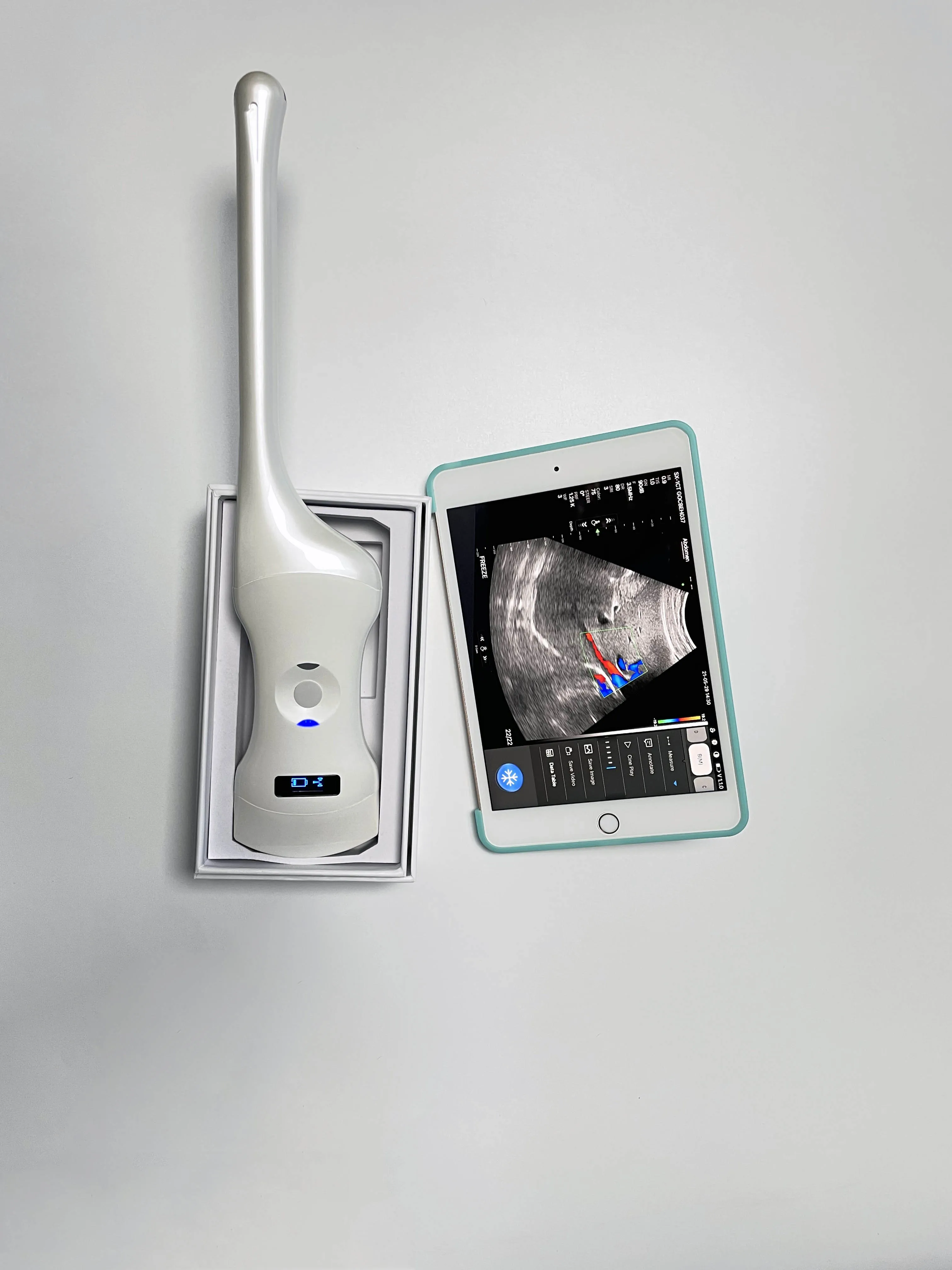 Handheld Drinkbaar Phased Array Cardiale, Lineaire, Transvaginale & Bolle 3 In 1 Kleur Doppler Ultrasound Scanner