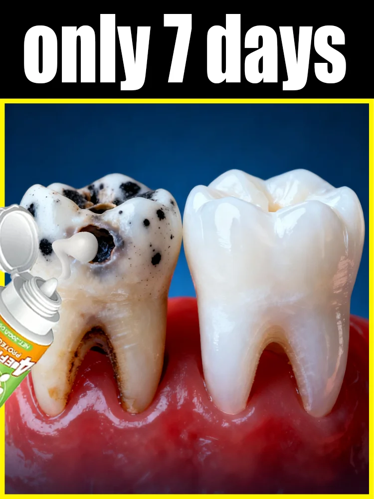 

Say goodbye to cavities and regain your perfect smile!