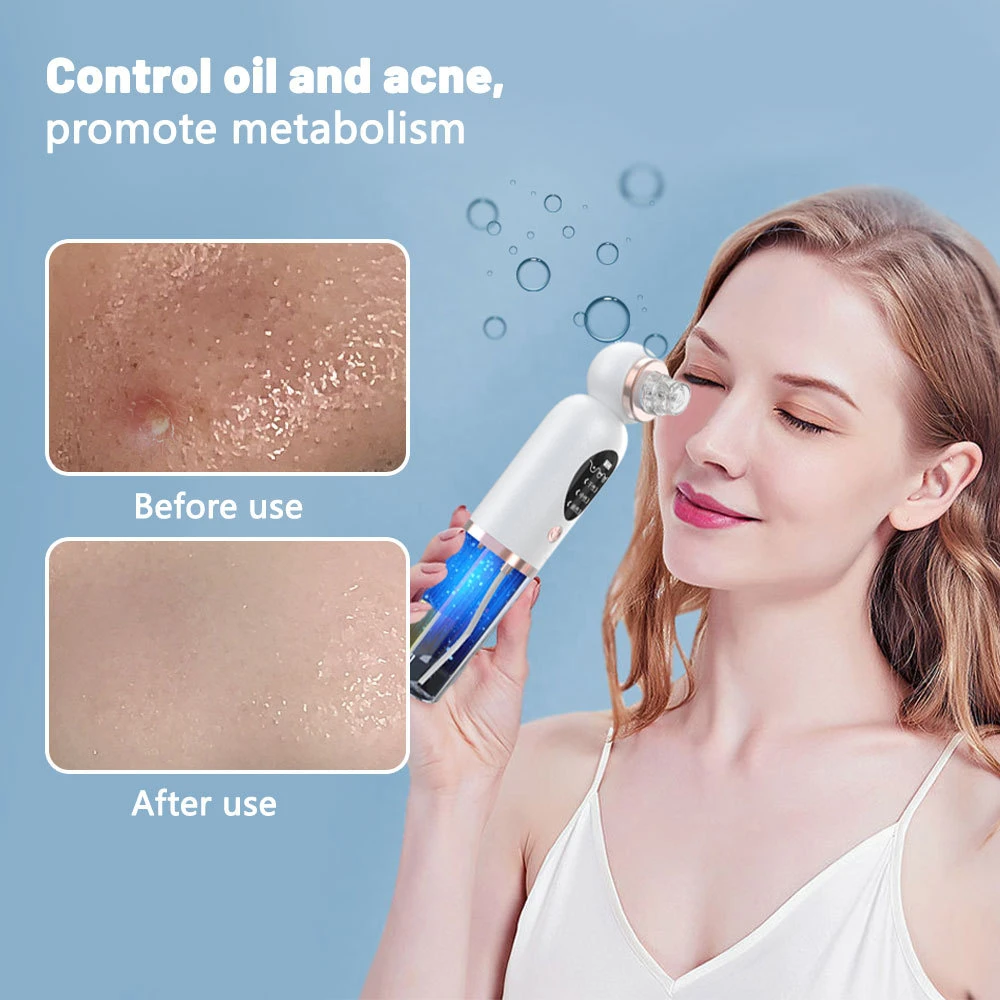 Electric Blackhead Removal Pore Cleaner, Facial Pore Cleaner -3 Adjustment Modes And 5 Probes, Facial Skincare Vacuum Cleaner US