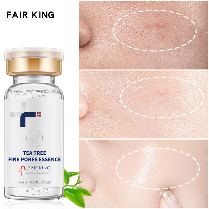 Chá árvore poro encolhimento ácido hialurónico hidratante soro facial melhorar os poros ampliados pele seca suave pele firme cuidados faciais