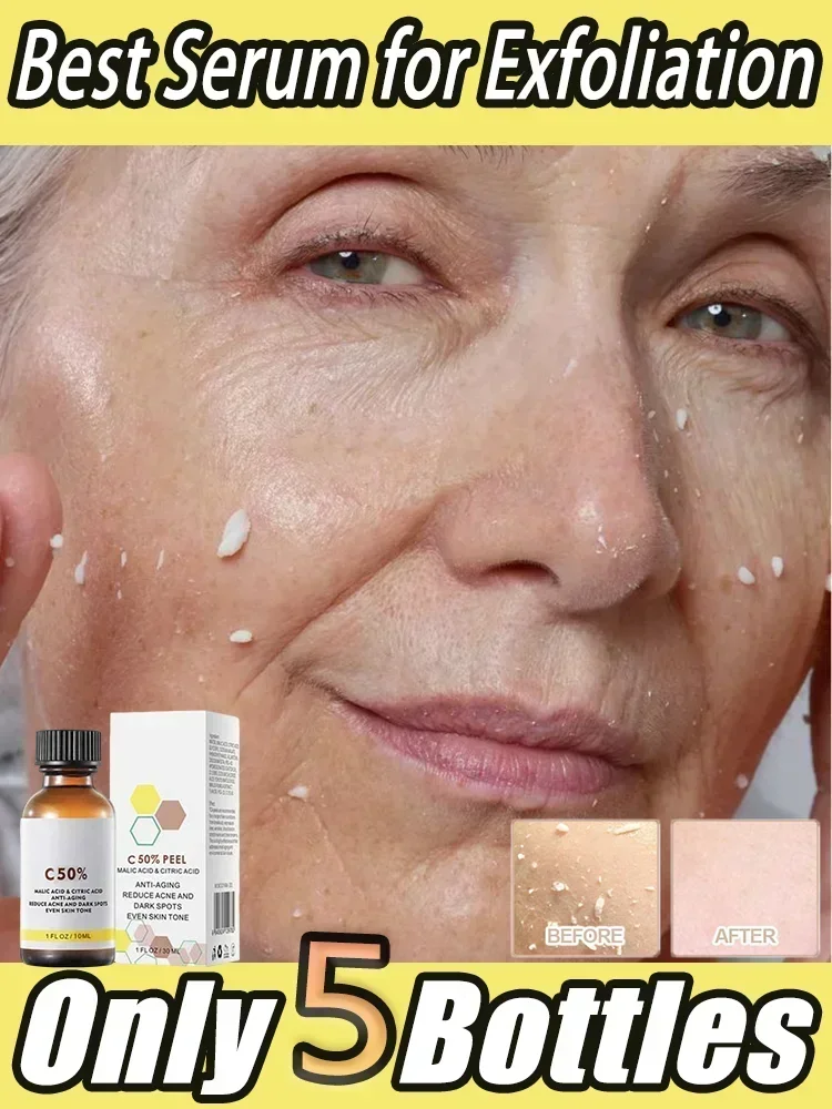 Peeling óleo branqueamento manchas escuras da pele remover morto clarear melanina esfoliante clarear hidratar rosto cuidados com a pele esfoliantes