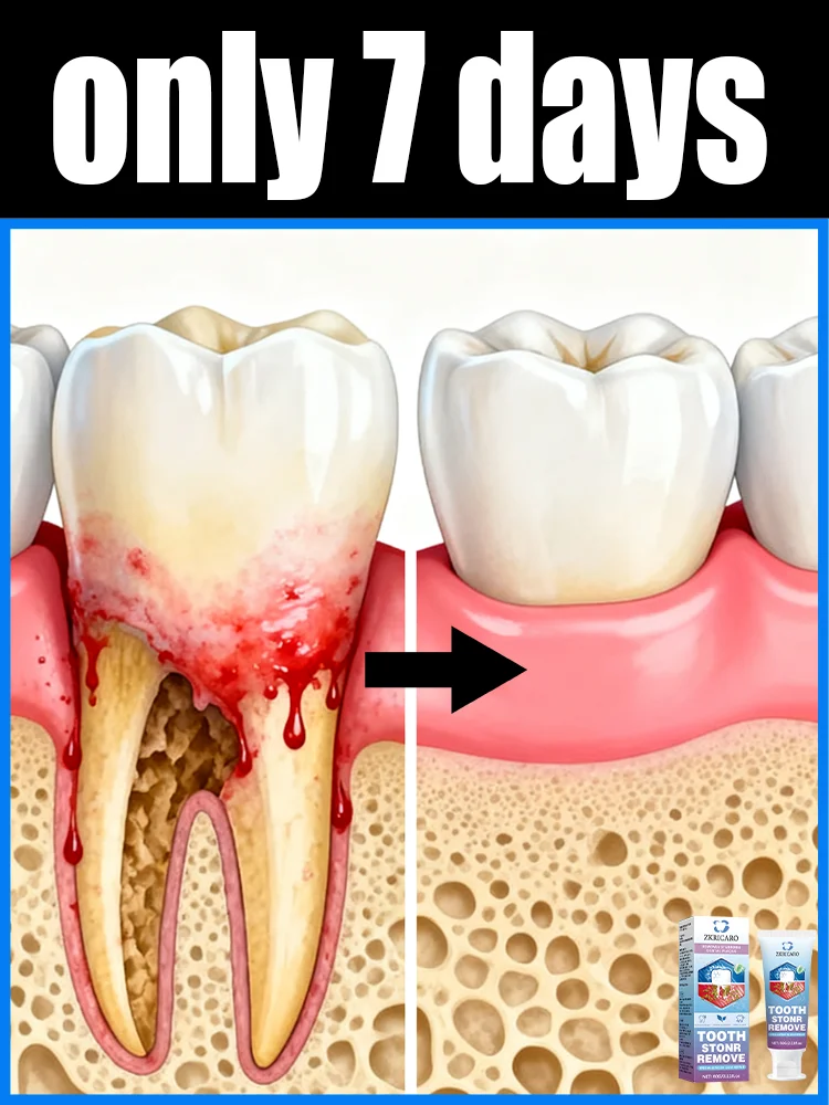 حل مشاكل أسنانك واستعادة ابتسامةك المثالية! #1
