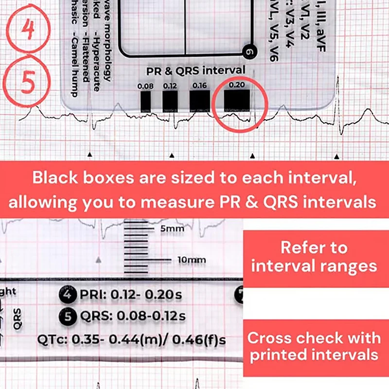 ECG 7 Step Ruler ECG Ruler Plastic Ruler Measuring Tool For ECG/EKG Interpretation Easy-to-Carry, With Protect Sheath