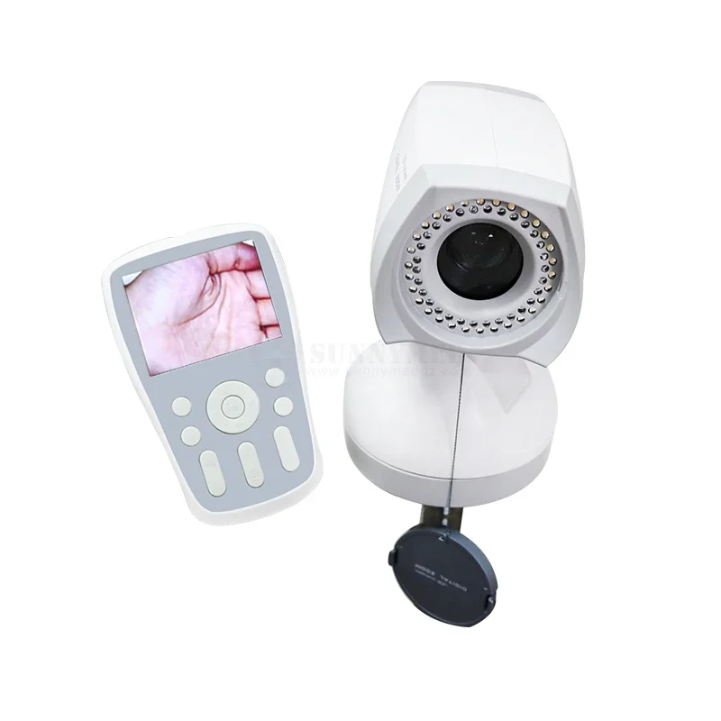 SUNNYMED SY-F005A Hot Sale Portable Digital Video  Gynecology Equipment