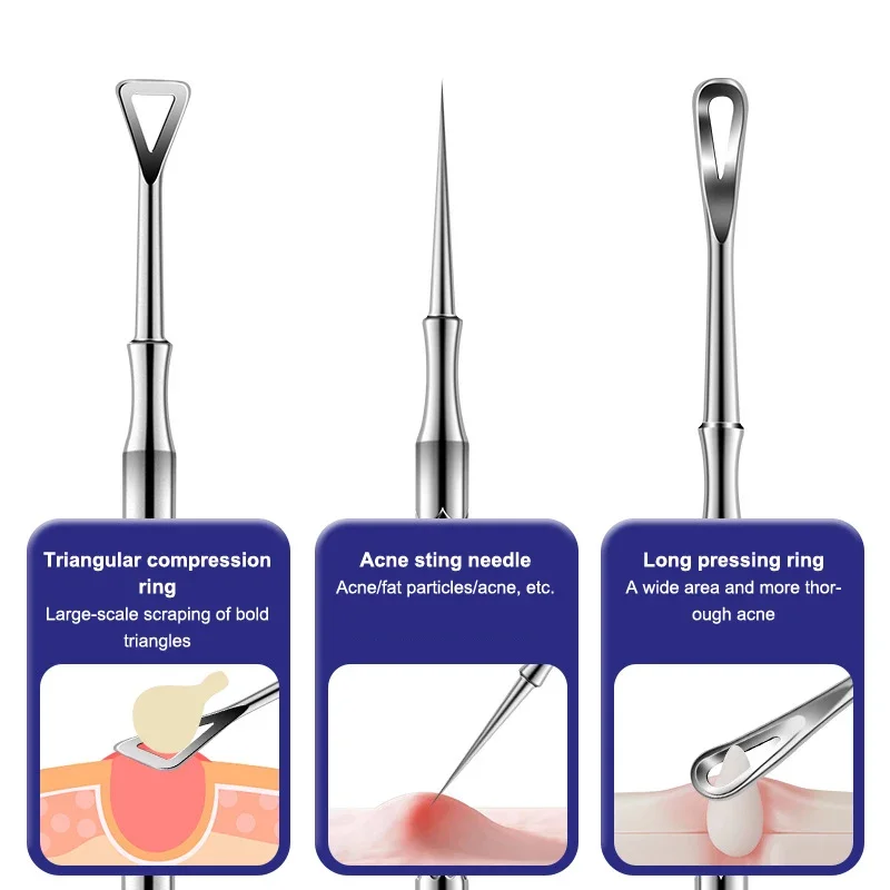 Comedondrukker Puistje Popper Tool Acne Naald Verwijderen Behandeling Whitehead Popping Zit Neus Gezicht Smet Extractor Cleanser