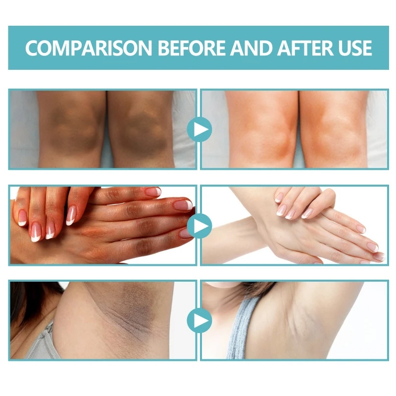 Black  Acanthoderma Repair Cream Moisturizes Skin Reduces Dryness and Pigmentation Brightens The Skin Repair Cream