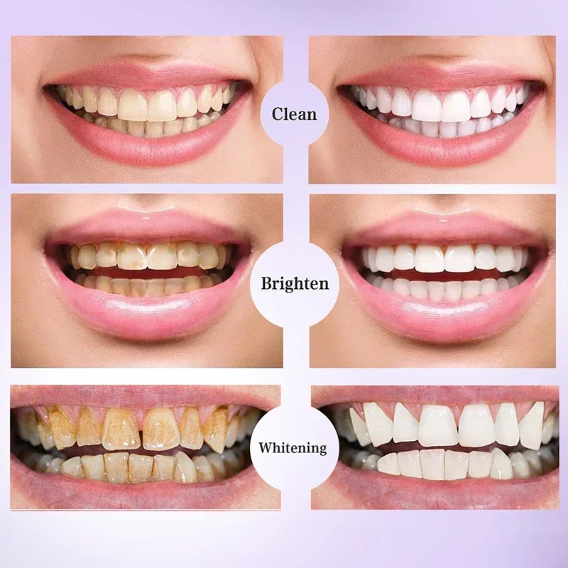 V34 30ml SMILEKIT Purple Whitening Toothpaste Fresh Breath Brightening Teeth Reduce Yellowing Care Remove Stains For Teeth Gums