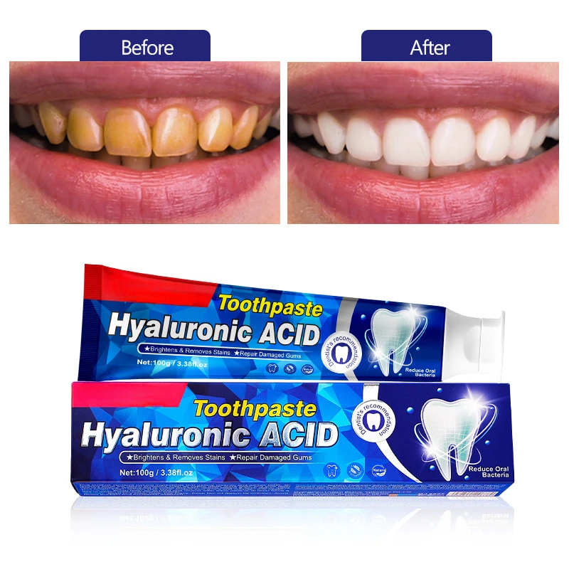 Dentifrice à l'acide hyaluronique pour la réparation des gencives, dentifrice dominatif, dents plus blanches, Charleroi Eve Gum et Soft Tissue Ferrand, 100g