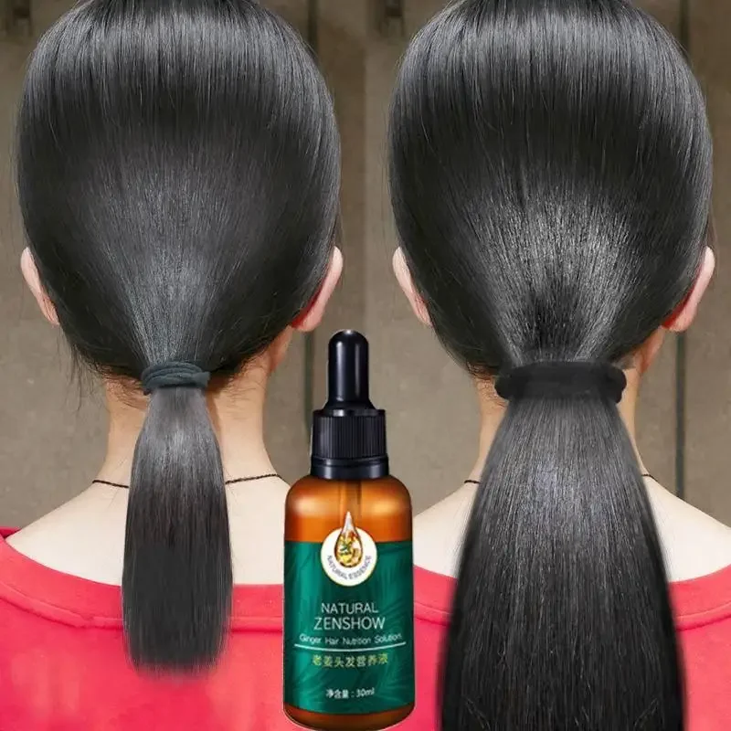 

Ginger эфирное масло для роста волос травяной уход за волосами против выпадения волос восстановление волосяных фолликулов стимулирует рост волос