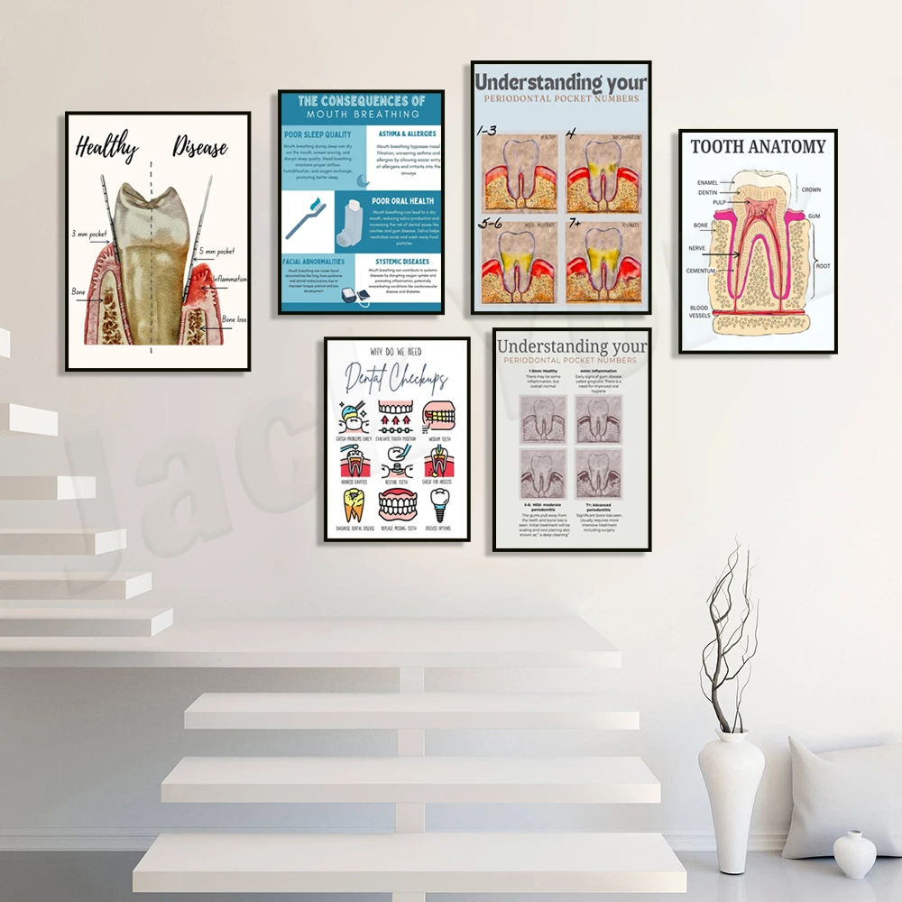 Periodontal disease, tooth sensitivity, tooth decay, caries, dental x-ray safety chart, gum disease anatomy poster, dental gift