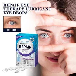 10 Pieces Of 18ml Red Eye Fatigue Dry Eye Care Liquid Special Dry Eye Lubricant Without Preservatives Relieve Eye Fatigue