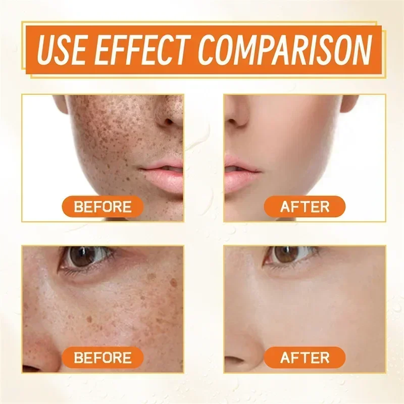 Skin Melanin Removal Serum Repair Facial Essence Whitening Spot Retinol Vitamin C Niacinamide Anti-Aging Brighten Moisturizing