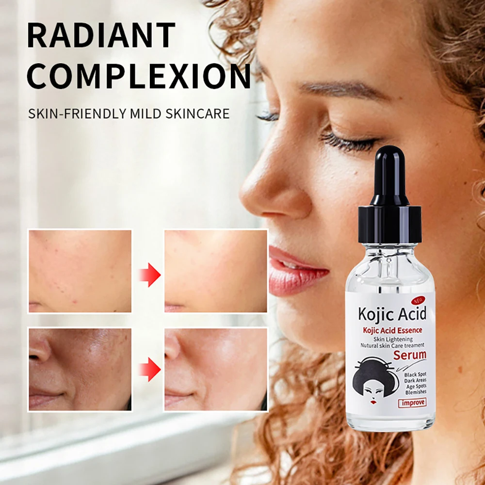 

Kojic Acid Original Solution Snail Face Serum Vitamin C Brightn Facial Serum Kojic Acid Face Care Oil Control Turmeric Essence