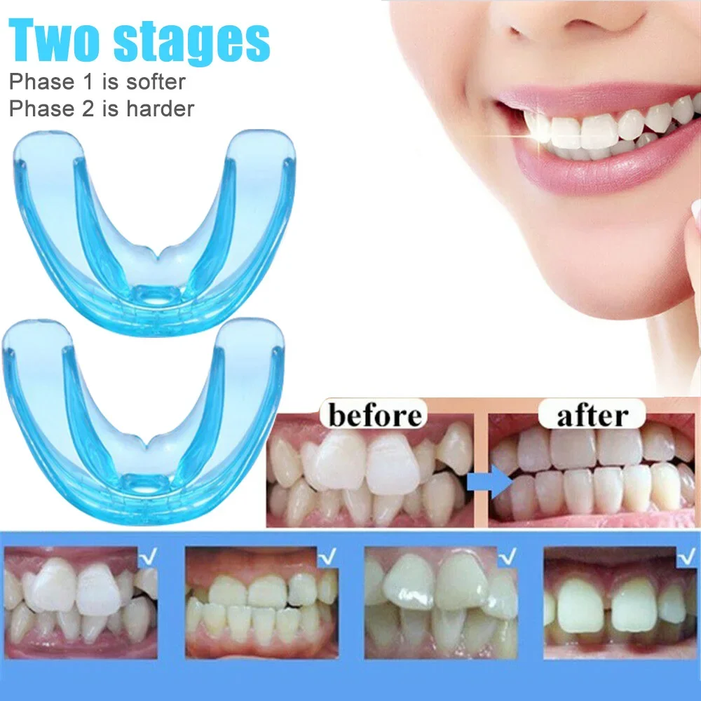 

Sdatter 2 Stages Dental Orthodontic Braces Appliance Braces Alignment Trainer Teeth Retainer Bruxism Mouth Guard Teeth Straighte