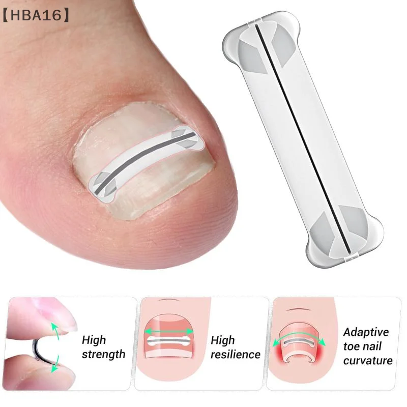 maveraHBA16 circulaire 13-20mm autocollants de Correction des ongles incarnés correcteur patchs Paronychia traitement récupérer correcteur pédicure aussi