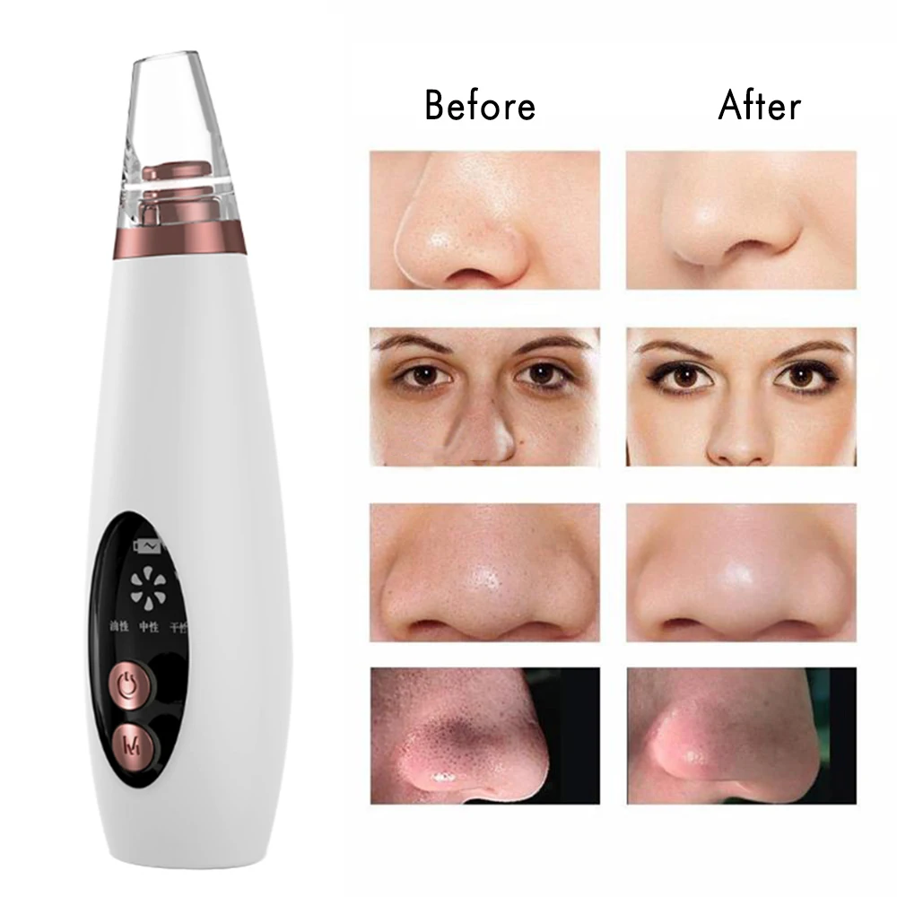 

Electric Facial Skin Care Pore Blackhead Remover Cleaner Vacuum Pimple Acne Removal Face Deep Pore 6 IN 1 Cleaner