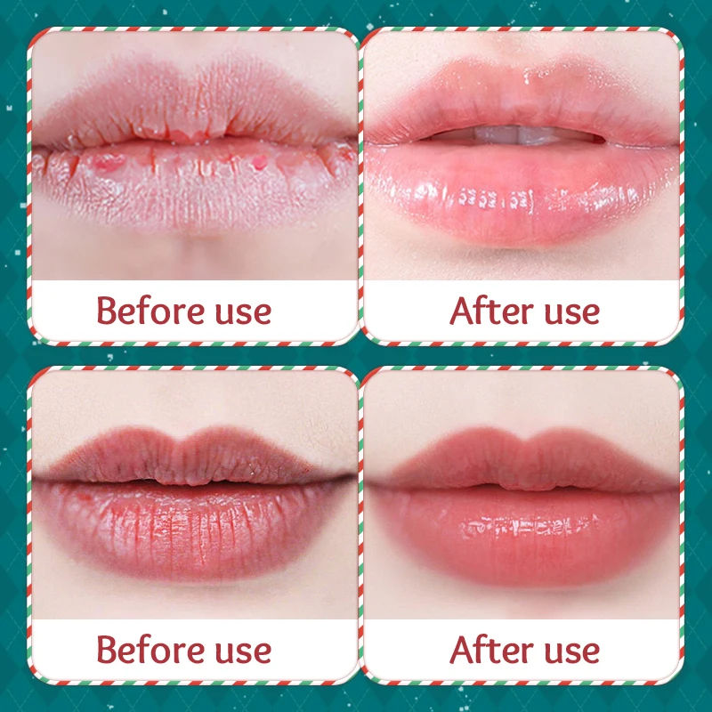 تريو للعناية بالبشرة لعطلة عيد الميلاد: كريم مرطب لليدين + لوشن للجسم + مجموعة بلسم الشفاه | عطر احتفالي، مهدئ للبشرة الجافة #6