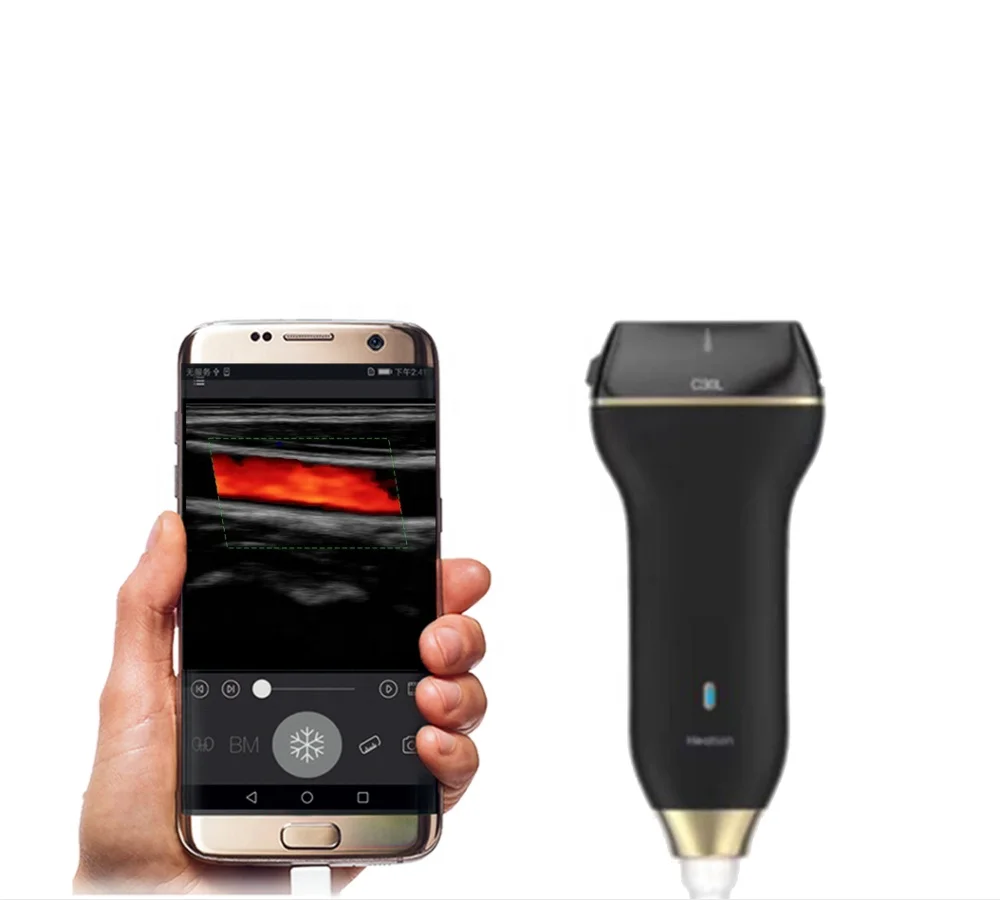 USB Handheld Pocket Echo Color Linear Probe Ultrasound Scanner System Veterinary Instrument