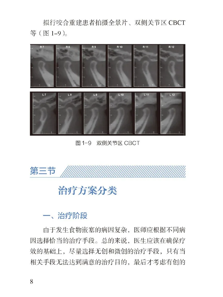 Book-Winshare Restorative Treatment For Food Impaction