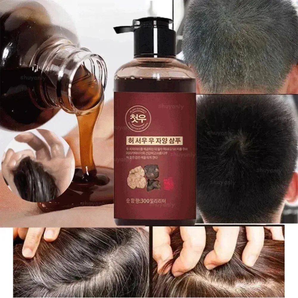 

300ml Herbal Natural Polygonum Multiflorum Shampoo Plant Liquid Grey White Hair Removal Turn Permanent Black Hair Growth Care