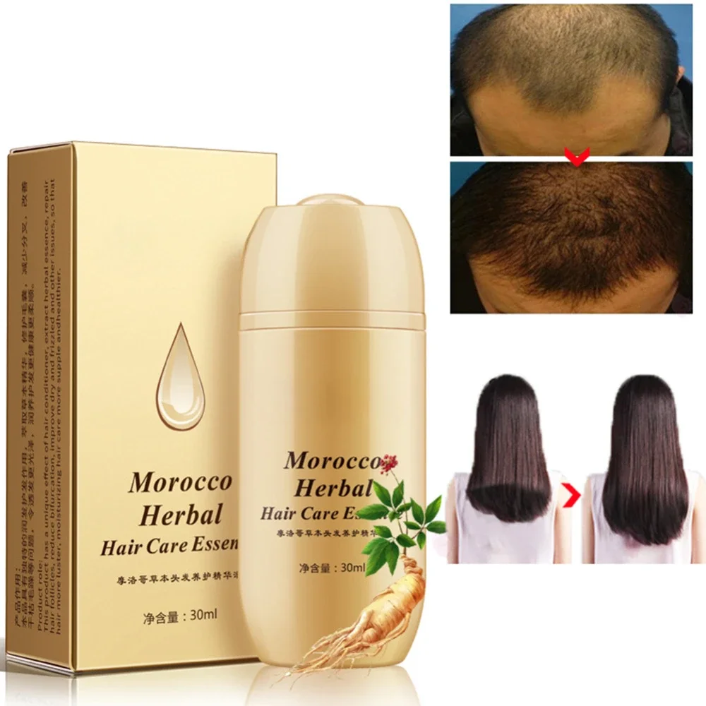 Huile d\'essence de croissance des cheveux marocaine, prévention de la perte de cheveux, favorise l\'optique capillaire, croissance rapide et injuste,