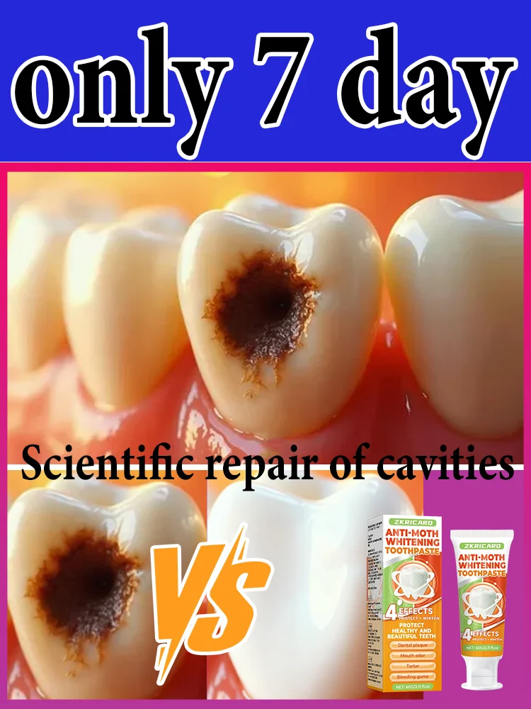 

Sᴄɪᴇɴᴛɪғɪᴄ Rᴇᴘᴀɪʀs Cᴀᴠɪᴛɪᴇs, Cʟᴇᴀɴs Pʟᴀᴏ̨ᴜᴇ, Wʜɪᴛᴇɴs Tᴇᴇᴛʜ