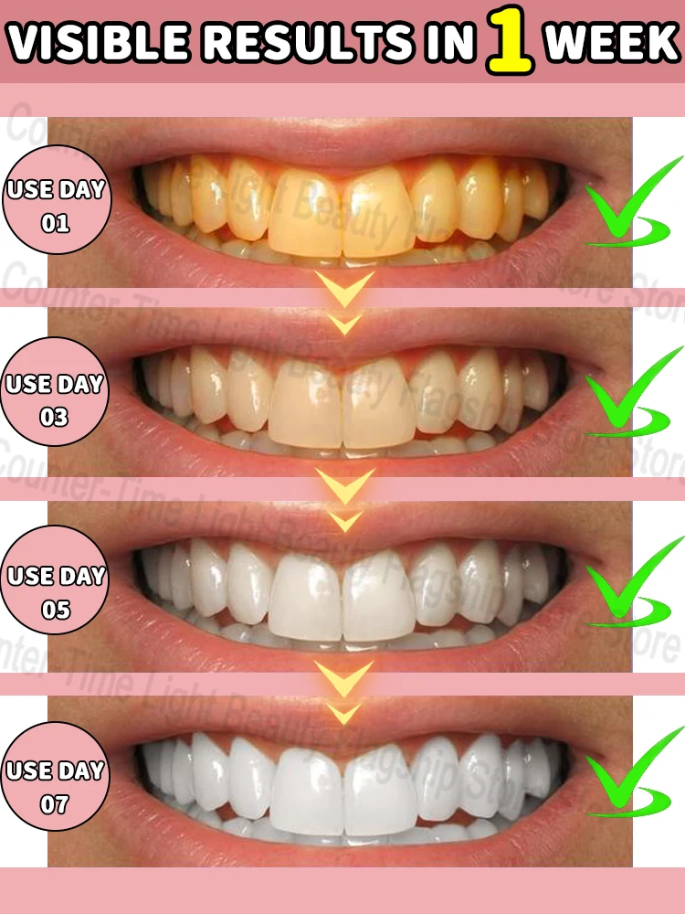Get white, sparkling teeth fast！