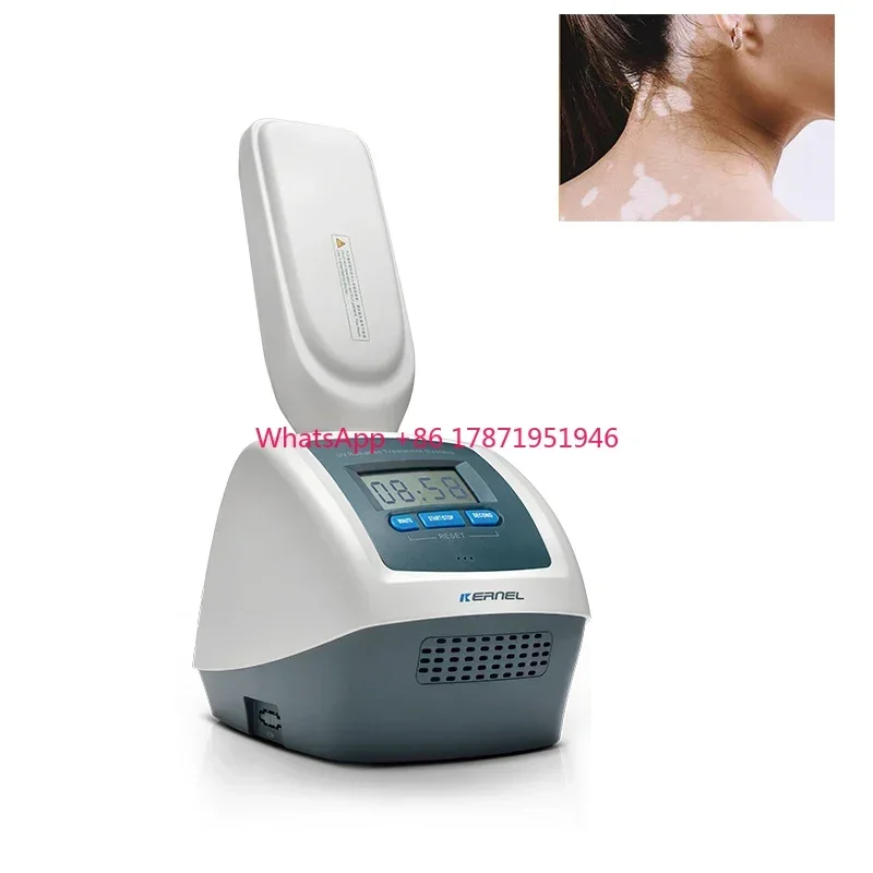 KN-4006B stable handheld portable UV lamps UVB Phototherapy UV therapy for eczema vitiligo psoriasis treatment