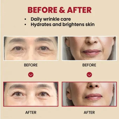 10 best sales आंखों में डालने की बूंदें - №3