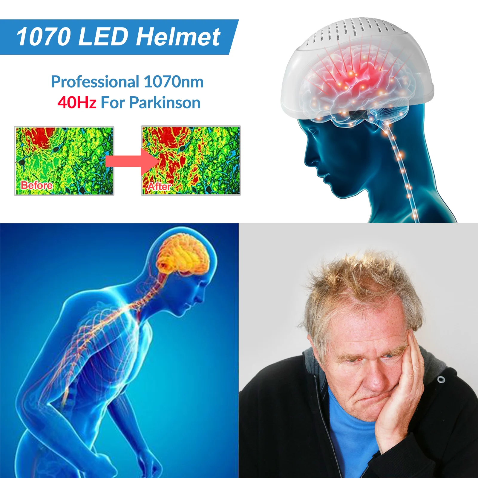 

1070nm 28W PBM Brain Helmet Near-Infrared Light LED Therapy Device Photobiomodulation for Alzheimer Parkinson Stroke Dementia