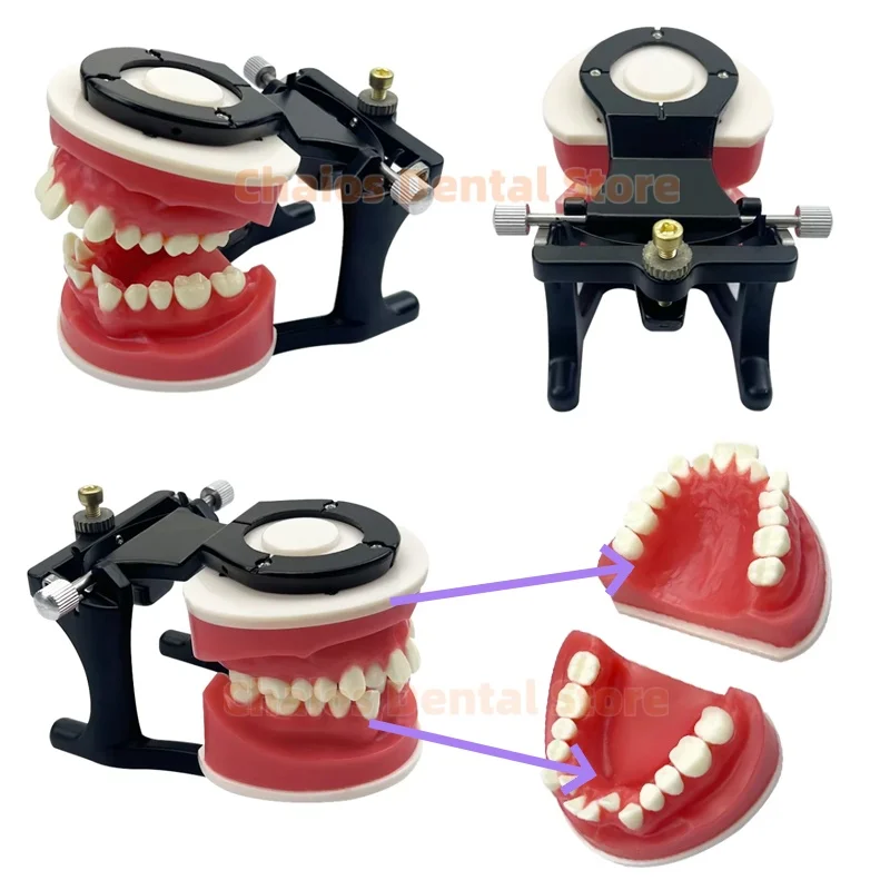 Dental Orthodontic Typodonts Model Gum Wax Embankment Teeth Practice Model With/Without Bracket Dental Teaching Study Demo Model