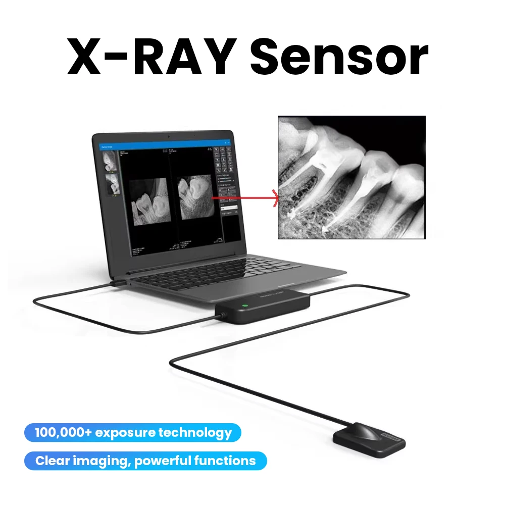 IP67 Waterproof Dentals X-ray Sensor DynImage Fast Transmission Digital Intraoral System