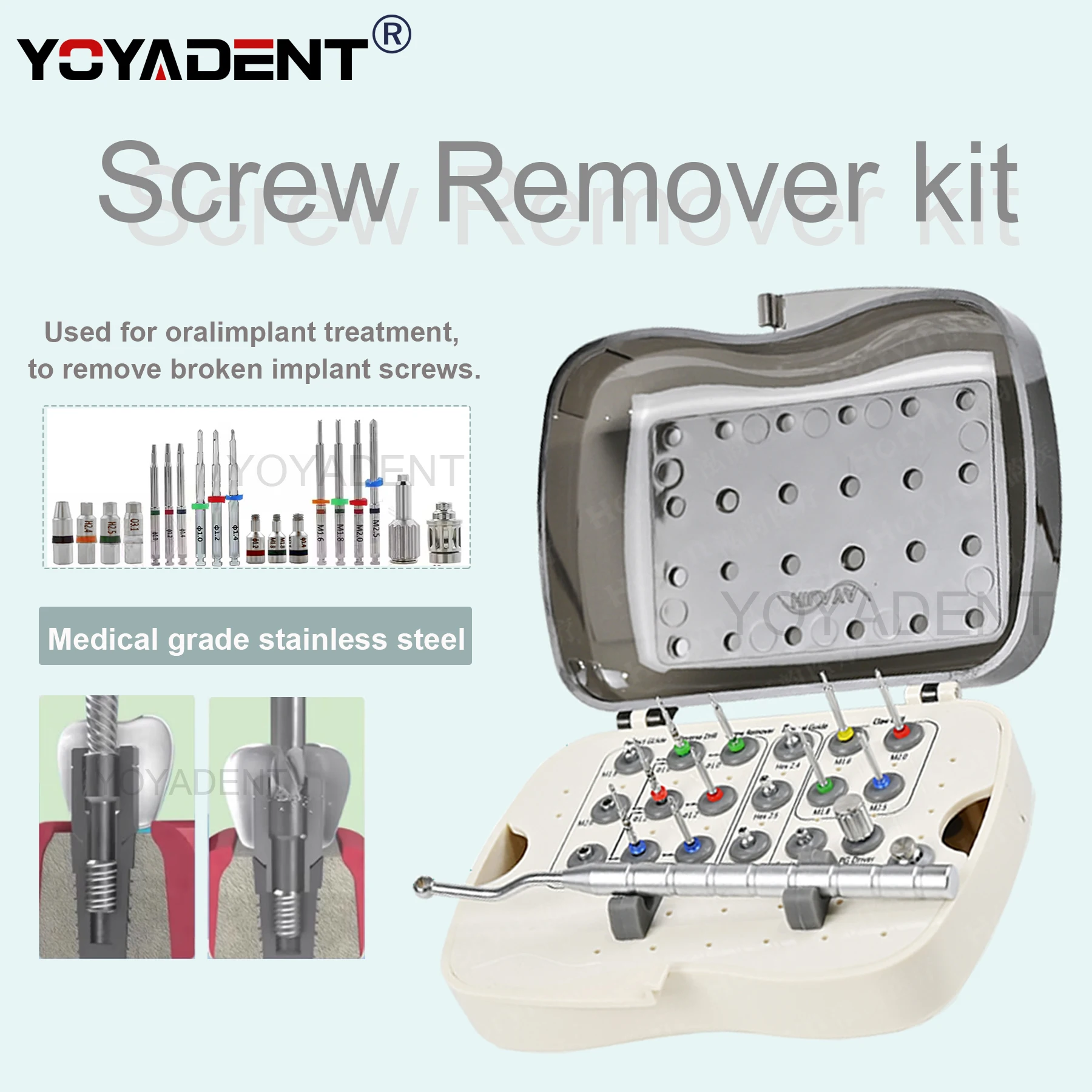 

Dental Implant Fractured Screw Removal Kit Fit for NeoBiotech SRK Stainless Steel Implant Screws Remover Broken Kit Dental Tool