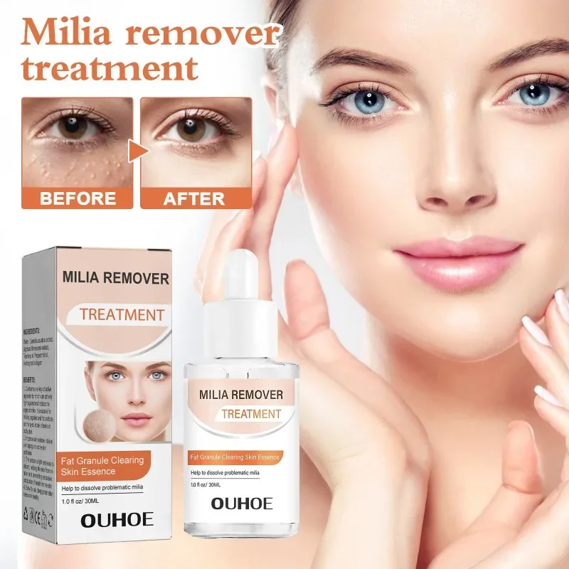 Milia Fleckent ferner straffen des Serum Akne Reparatur Fett Granulat Milia Spot Augen taschen dunkler Kreis Anti-Aging feuchtigkeit spendende Augen pflege 30ml