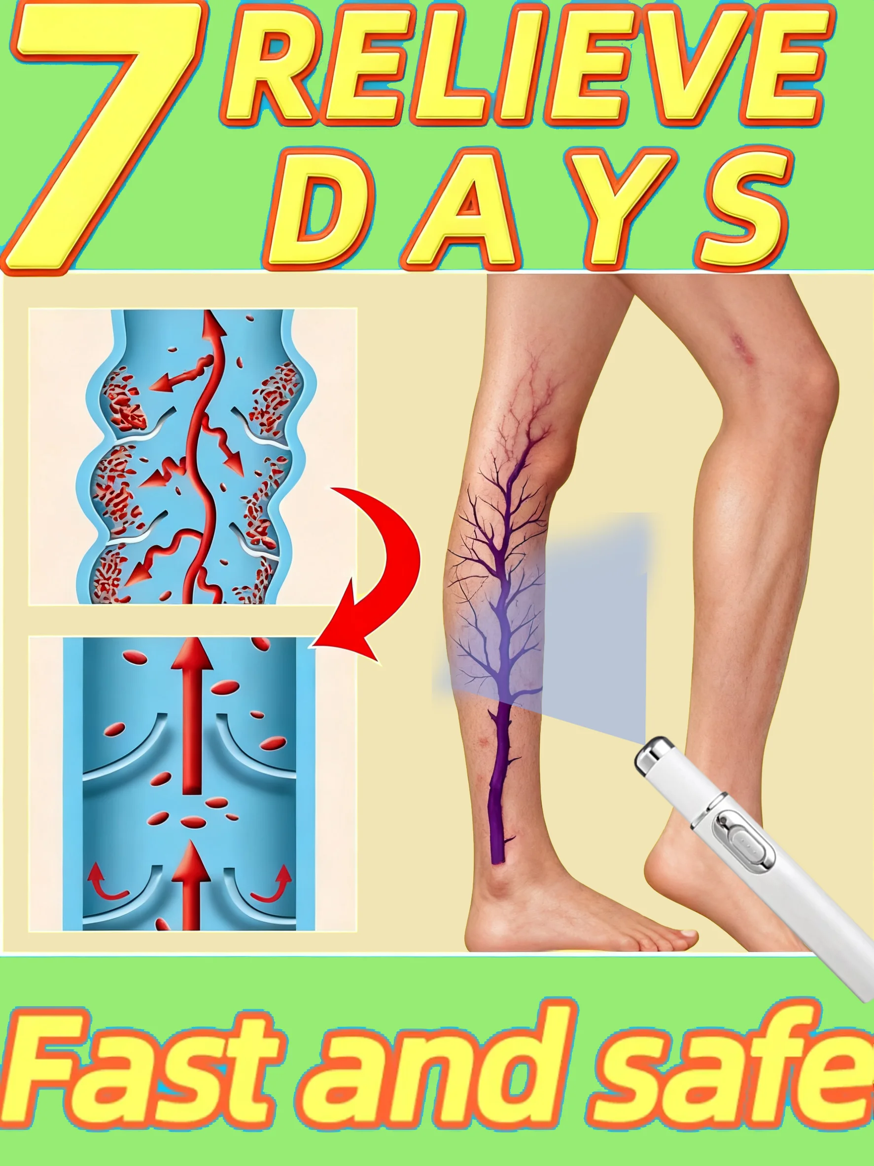 

Новая модернизированная лазерная ручка с синим светом нагрева 2-го поколения для лечения варикозного расширения вен и инструмента для управления здоровьем ног