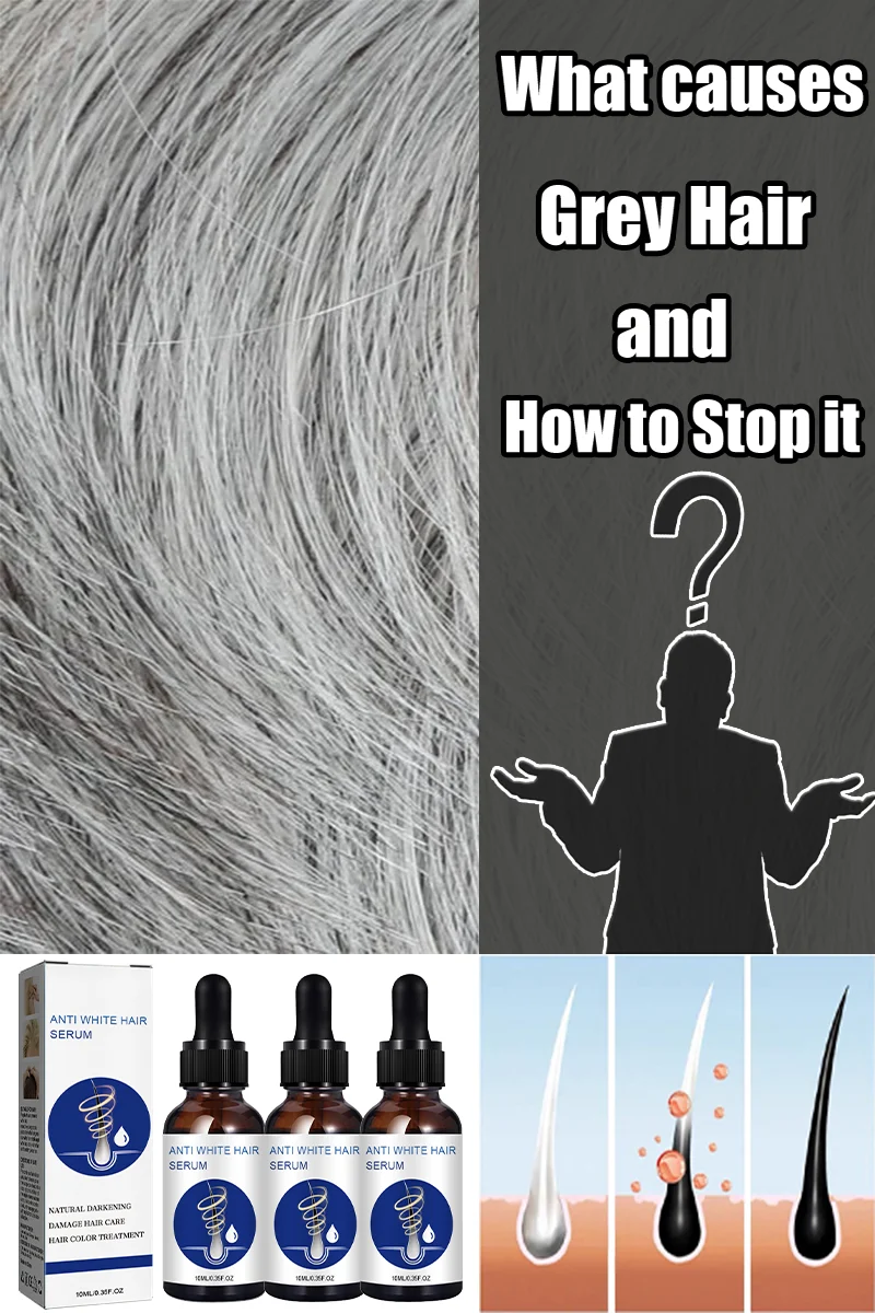 

Natural Anti-Grey Hair Essence Serum No hair color No allergies Anti-grey hair essence Serum Remedy Healthy Product