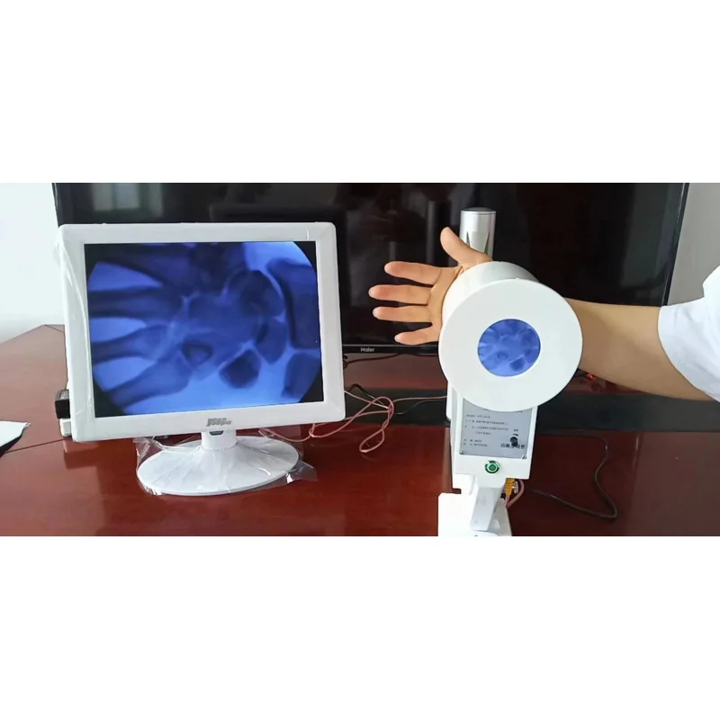 

15-inch LED TV display portable x-ray inspection system Medical Fluoroscope Machine