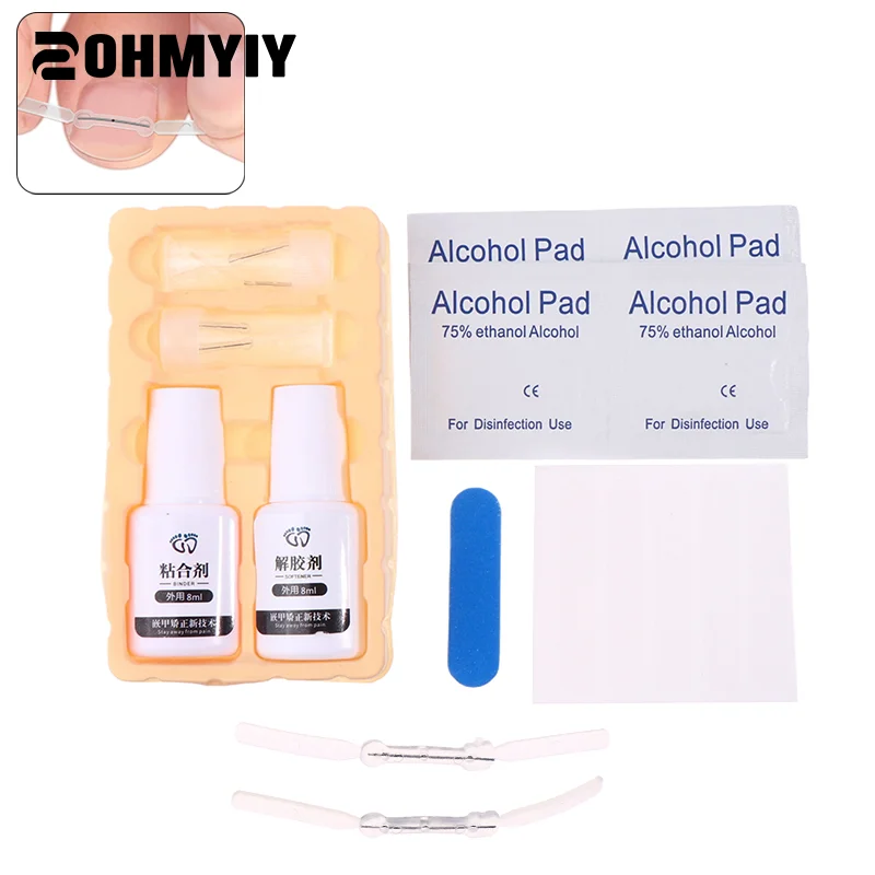 4 ピース/セット陥入爪矯正ツール陥入爪治療弾性パッチステッカー矯正クリップブレースペディキュアツール