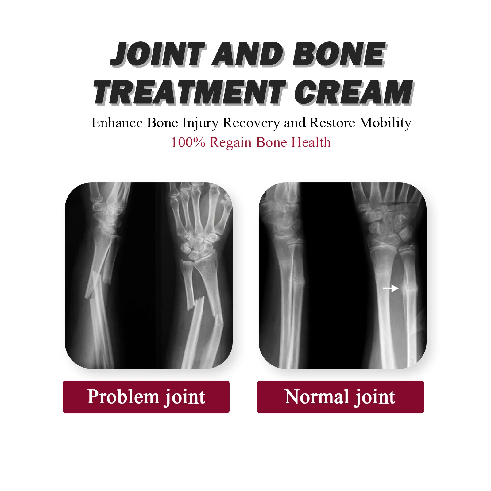 South Moon Soothing Joint Bone Soreness, Deformation Correction and Repair, Joint Bone Collagen Cream