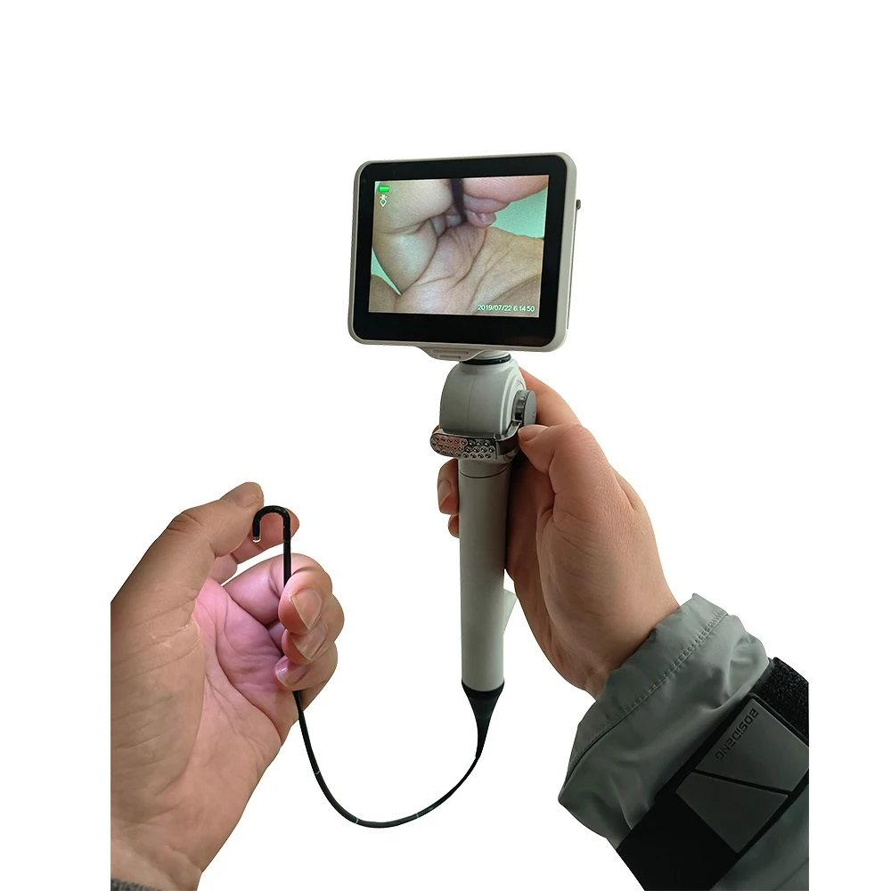 Professional Flexible Electronic Bronchoscope - Camjoy HD Visual Laryngoscope for Easy Airway Inspection and Diagnosis
