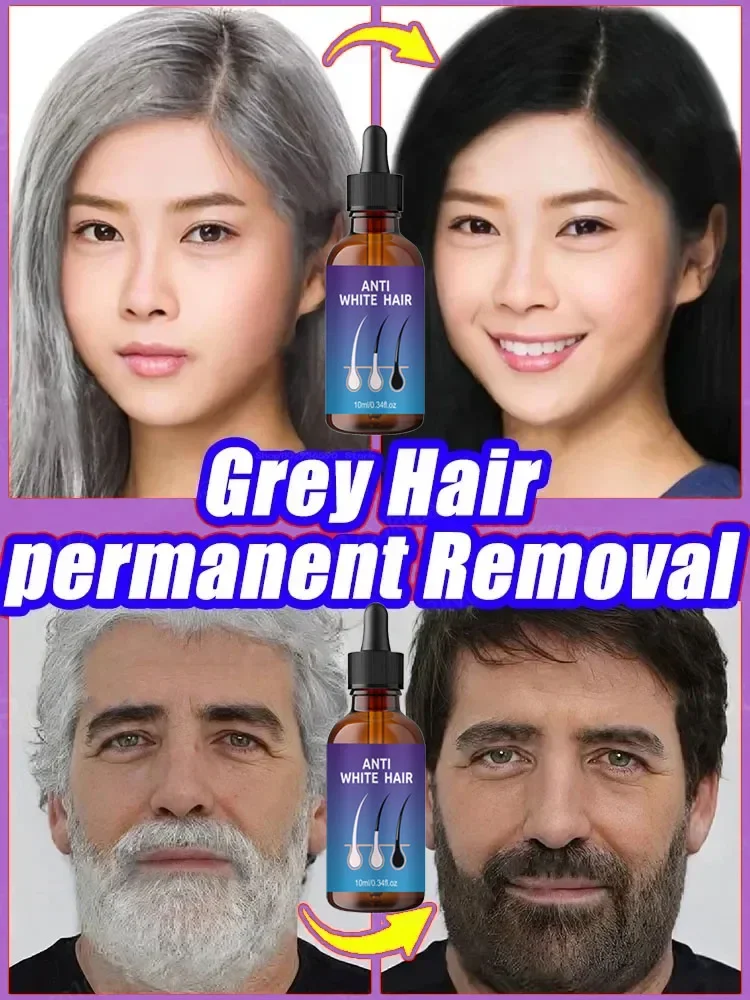 Natural Anti Grey Hair Serum Nourishing Hair Care Remedy Repair White & Darkening Hair