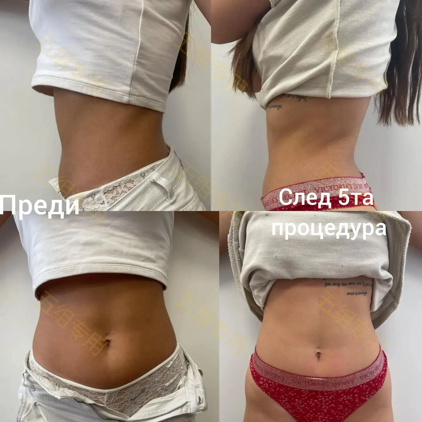 

EMS Hi-emt Body Sculpt Machine Neo RF Vacuum Inner Ball Roller Machine 360 Degree Rolling Cellulite Removal Weight Loss Slimming