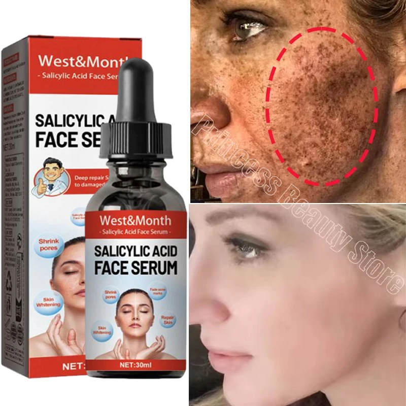 

Powerful Spot-removing Facial Serum Niacinamide Whitening Essence Remove Melanin Brighten Pigmentation Melasma Korean Skin Care