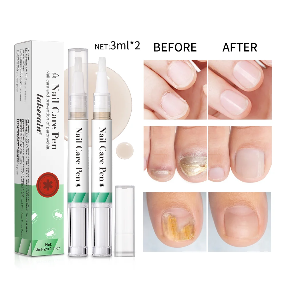 Nail Care Pen Nail Fungus Pen Austria Nail Fungus Test Winner Nail Polish Cosmetic Care for Nail Fungal Infection Health Routin