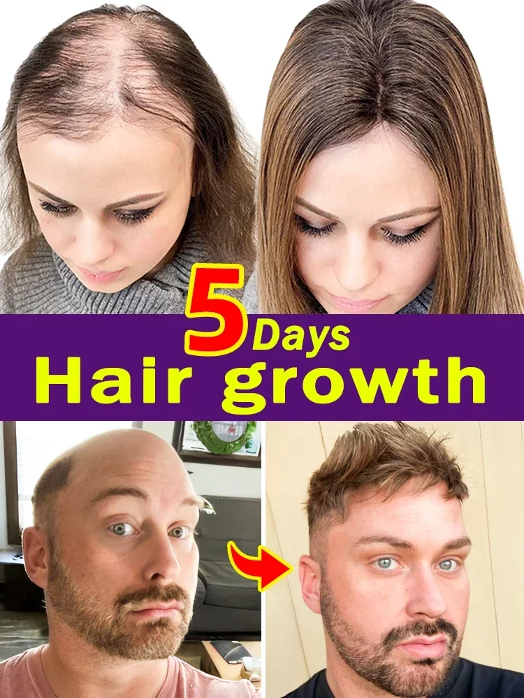 

Fast Hair Growth Oil For Products Men Women