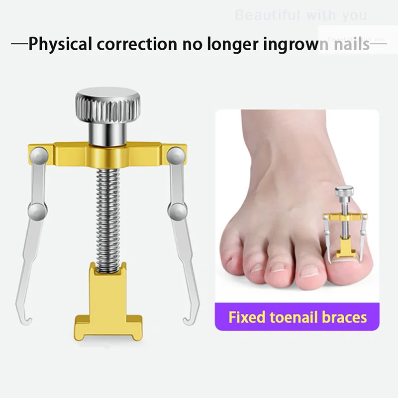 

Ingrown Toenail Toe Fixer Recover Correction Device Pedicure Foot Nail Care Tool
