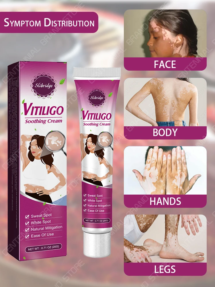 Crème apaisante Vitiligo pour le visage, crème de repigmentation Vitiligo pour les taches blanches