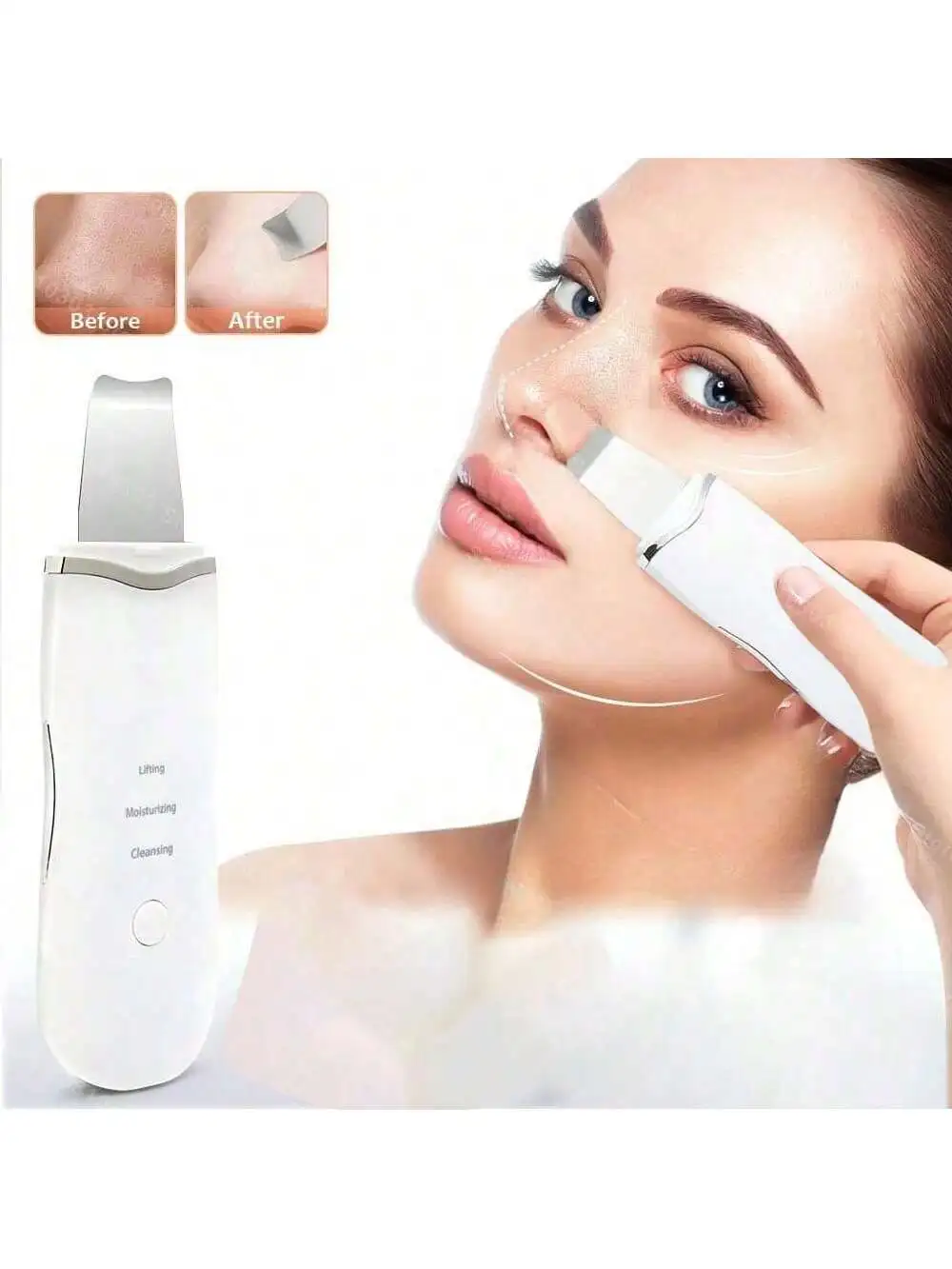 Ultrasone Huid Scrubber Scrubber Diepe Trillen Gezichtsreiniger Schop Gezicht Scrubber Peeling Black Head Remover Gezichtsmassager