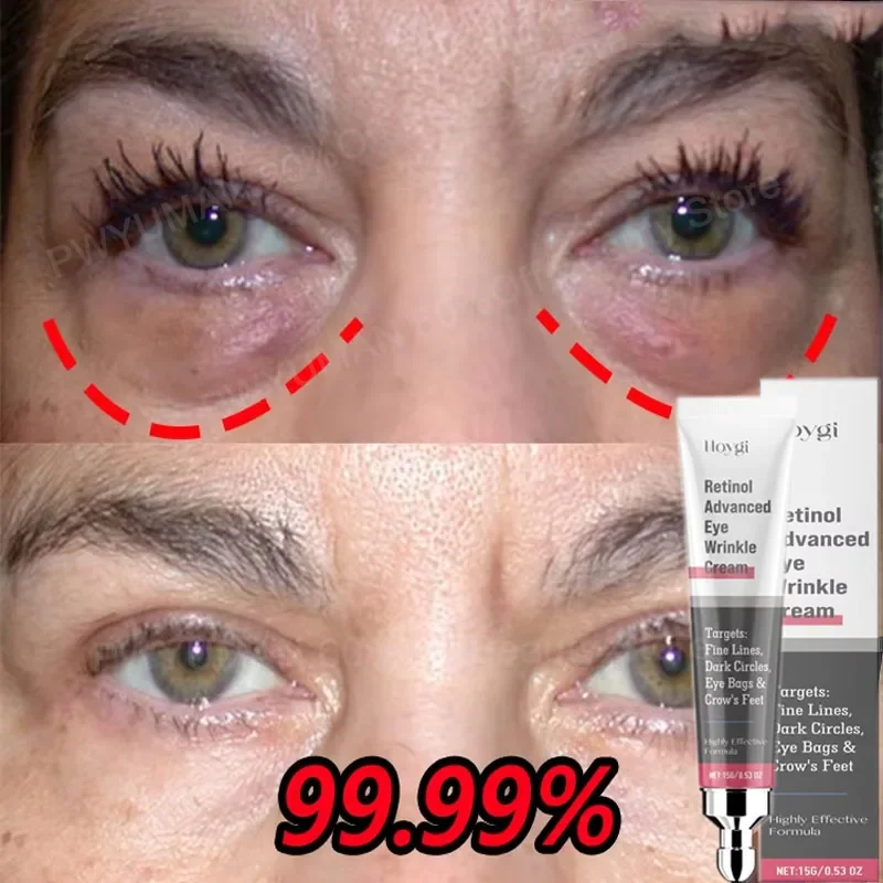 

Instant Eye Bag Removal Cream Retinol Anti-Wrinkle Lifting Firming Fade Fine Lines Anti Dark Circle Puffiness Brighten Eye Care